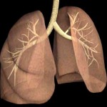 Akciğer amfizemi neden olur?
