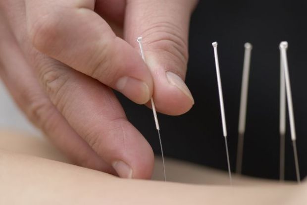 Akupunktur şifa kaynağı
