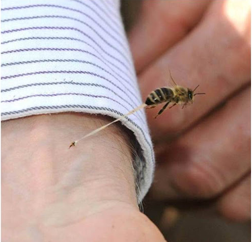 Arı sokmasının faydaları nelerdir?