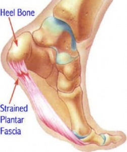 Ayak ağrılarının nedenleri ve tedavisi
