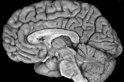Bilim adamları deriden beyin hücresi üretti!