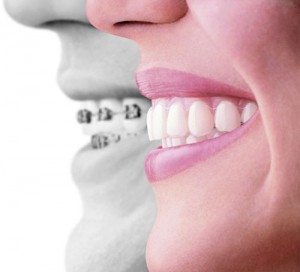Diş Anomalileri Faydaları