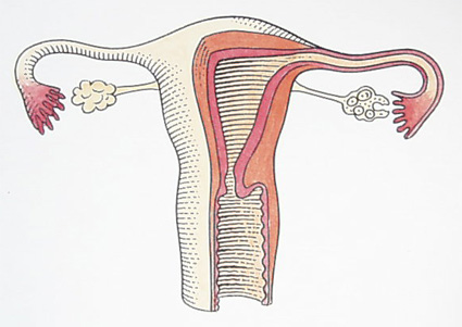 Endometriyozis