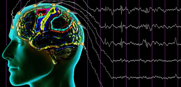 Epilepsi Hakkında Soru Ve Cevaplar