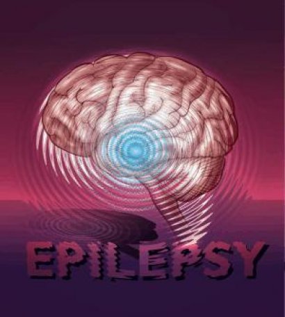 Epilepsi ve Parkinson tarihe mi krışıyor?