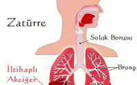 Akciğer iltihabı belirtileri nelerdir?