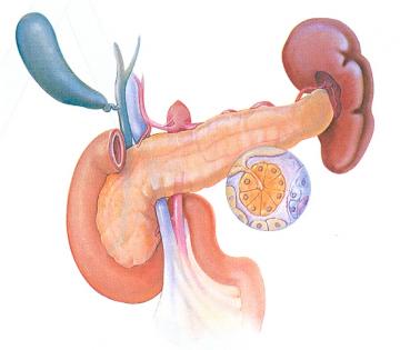 Akut pankreas iltihabı tedavi