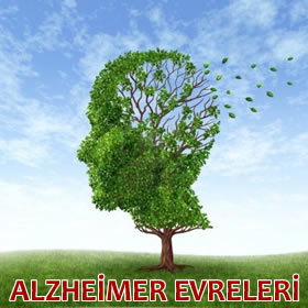 Alzheimer hastalığının evreleri