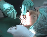 Diş kisti ameliyatı nasıl yapılır?