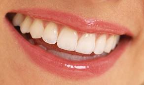 Dişler nasıl sağlıklı olur?