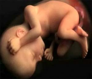Doğum Travmaları Bebeği Nasıl Etkiler?