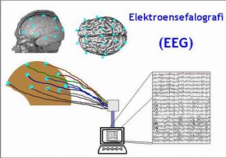 Elektroensefalografi (EEG) Nedir?