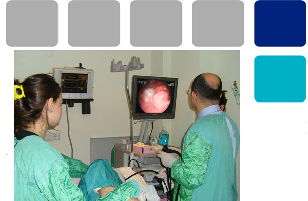 Endoskopi nasıl yapılır?