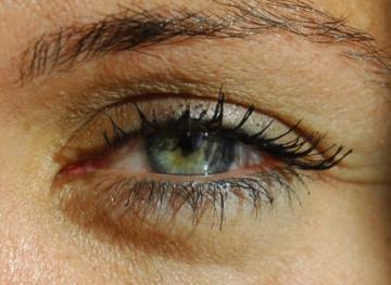 Göz tansiyonu ve tedavisi