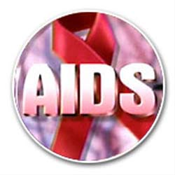 HIV virüsü belirtileri nelerdir?