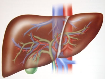 Karaciğer Hasarı Nedenleri Ve Tedavisi