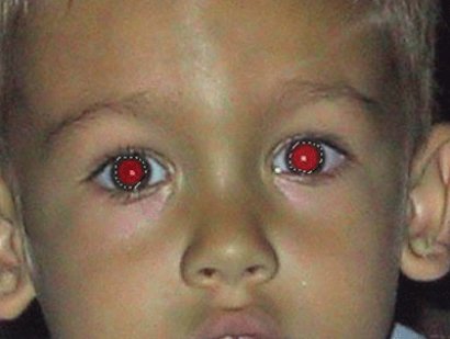 Kırmızı göz hastalığına dikkat