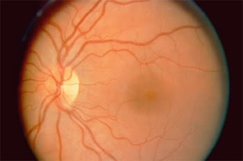 Retina Faydaları