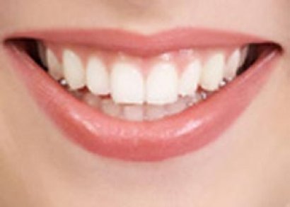Sağlıklı Dişler İçin 5 Pratik Öneri